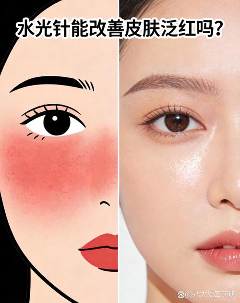 产后恢复